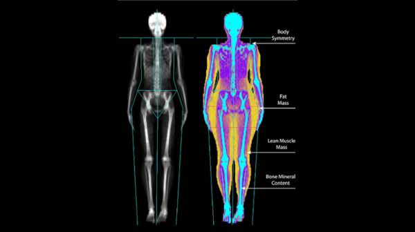 How to Measure Weight Loss and Unlock the Mystery using DEXA scan